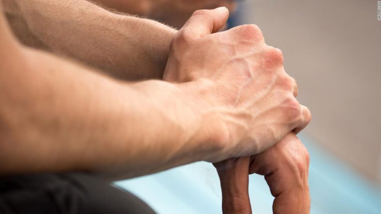 Forget fingerprints — AI may soon use your veins to identify you