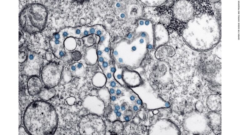 More evidence severe Covid-19 can affect brain function, study finds