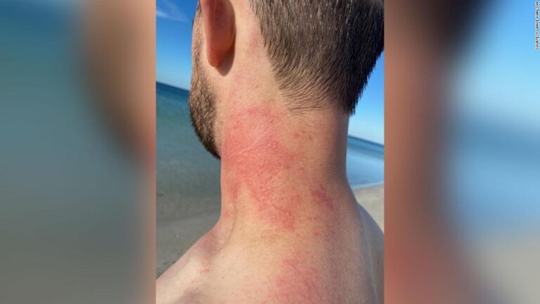 Man comes face-to-face with angry octopus in rare attack