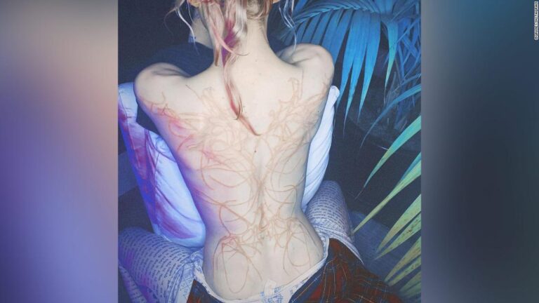 Grimes shows off the ‘beautiful alien scars’ she’s had tattooed across her back