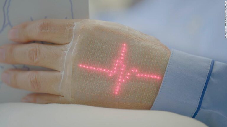 Wearable electronic skin could monitor your health