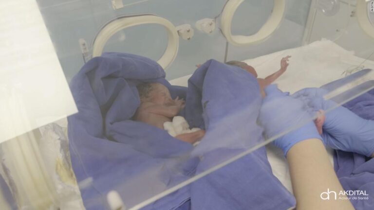 Tiny nonuplets have a fight ahead, hospital says