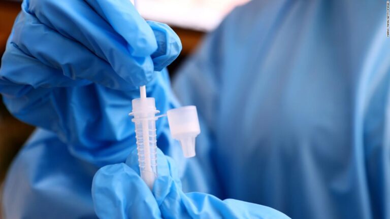 What experts are learning about Lambda, a coronavirus ‘variant of interest’