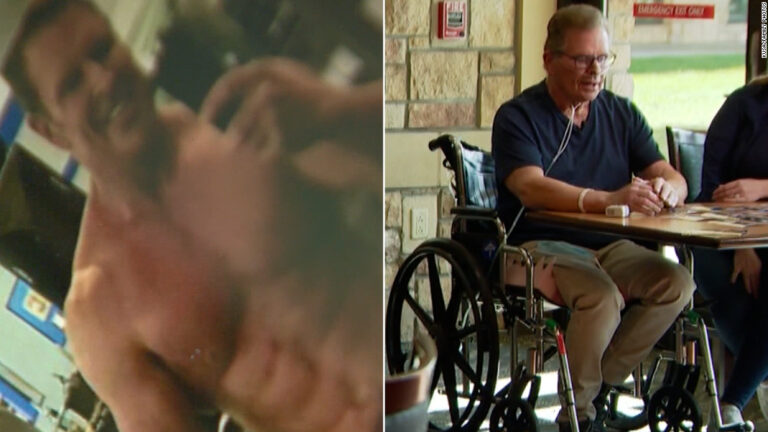 Fitness trainer declined vaccine. Stunning photos show what happened to him