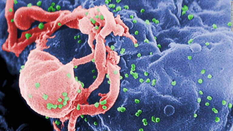 A second HIV patient may have been ‘cured’ of infection without treatment