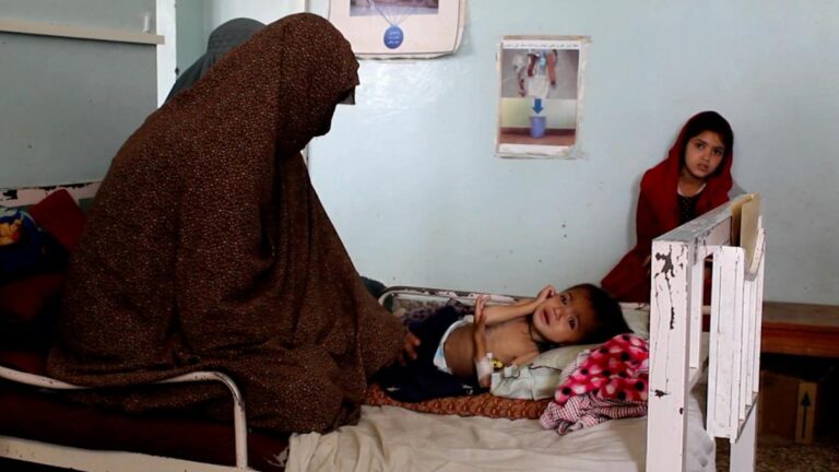 Heartbreaking images reveal levels of child starvation in Afghanistan