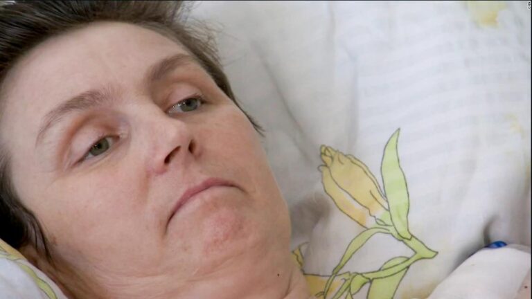 Wounded Ukrainian woman speaks to CNN after 7 bombs hit her neighborhood