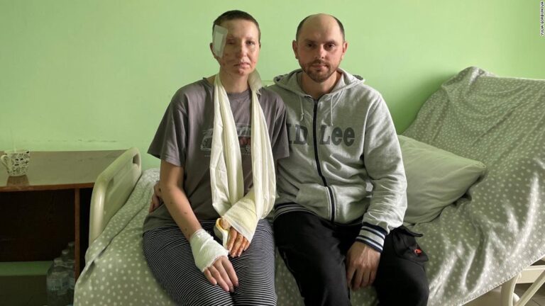 A Russian soldier asked how she lost her eye. Here is the awful truth