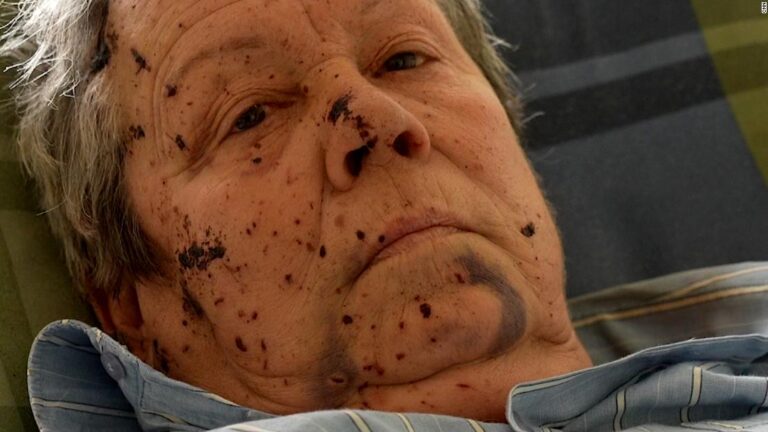‘I’m all scratched and battered’: Ukrainian woman loses brother and home to Russian rocket