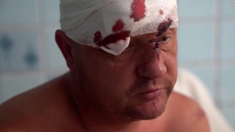 ‘I saw people burnt:’ Survivors describe airstrike on Ukraine mall