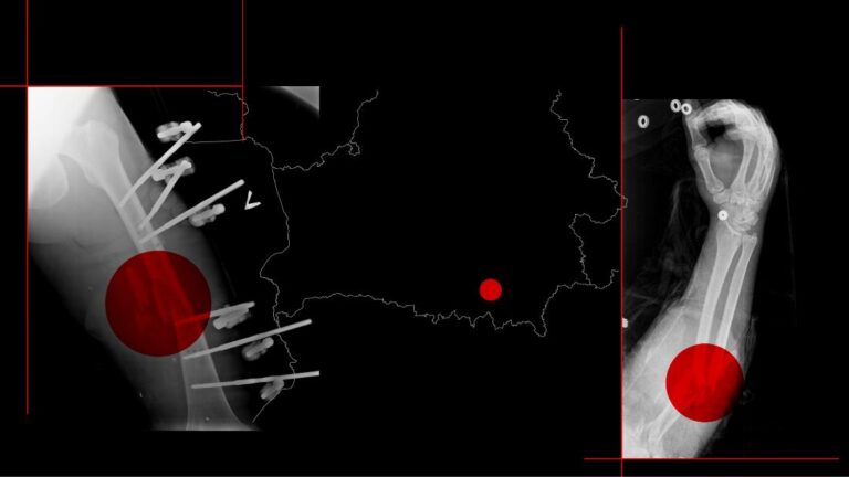 Inside the hospitals that concealed Russian casualties